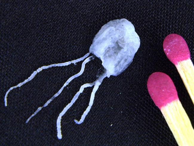 In this April 18, 2002 file photo taken at James Cook University in Cairns, Australia, a tiny but fully grown deadly Irukandji jellyfish lies next to match sticks for size comparison. AP Photo/Brian Cassey.