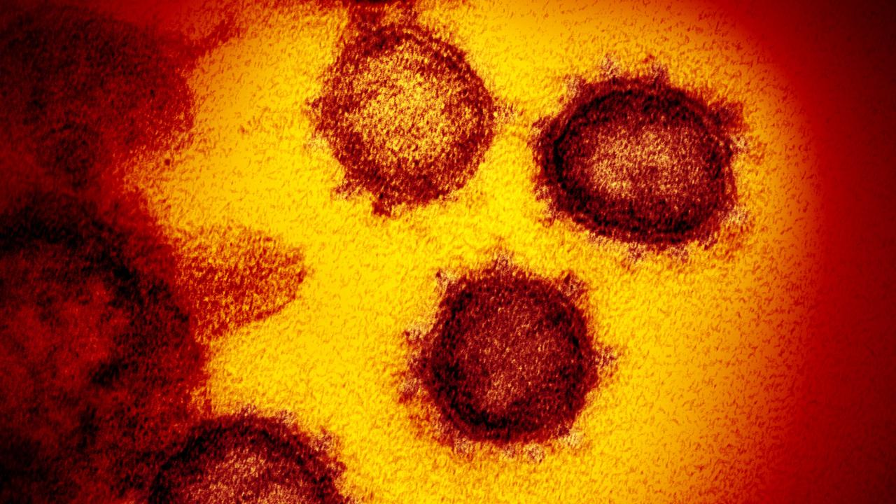 An electron microscope image issued by US National Institutes of Health in February 2020 showing the novel coronavirus 2019-nCoZV, the virus that causes COVID-19. Picture: NIAID-RML via AP