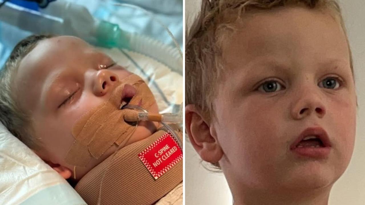 Autistic child fighting for life after horror hit and run