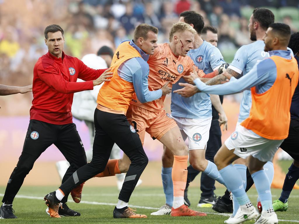 Glover had to be escorted off the field after being struck by a bucket. Picture: Darrian Traynor/Getty Images