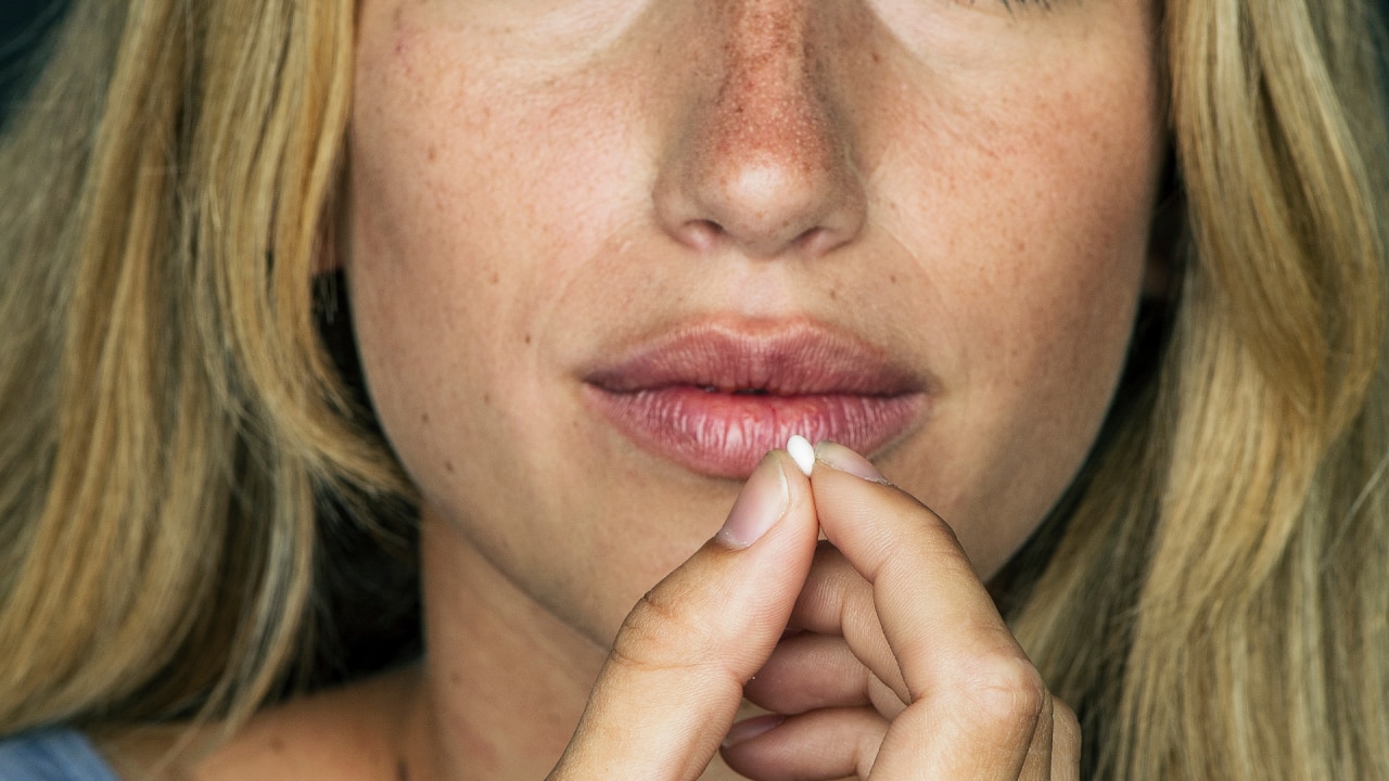 How the contraceptive pill causes skin pigmentation and melasma | body+soul