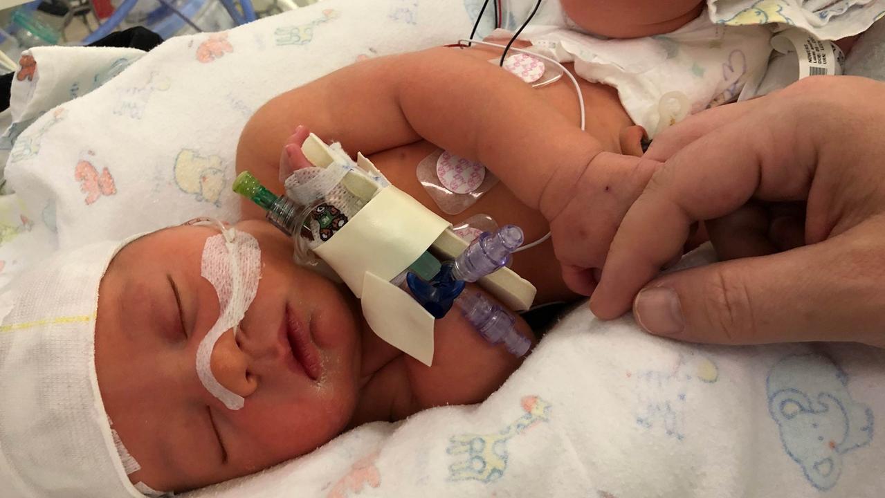 When he was nine days old Lucas was diagnosed with a rare form of genetic epilepsy. Picture: Supplied.