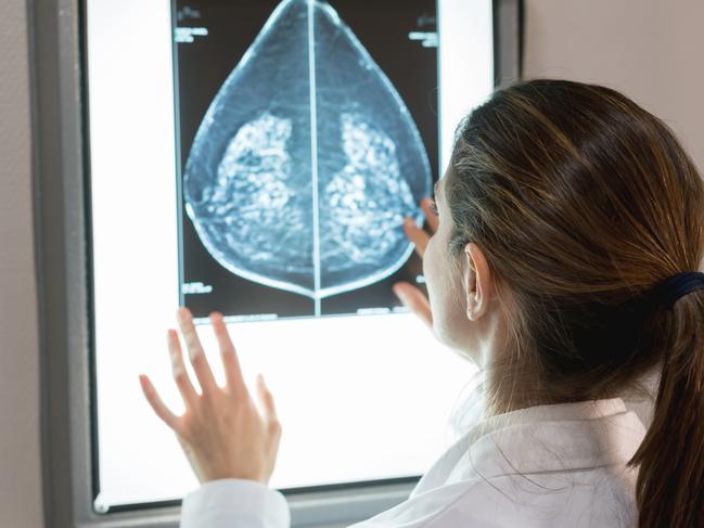 Unrecognizable female gynocologist looking at a patients mammogram at the hospital