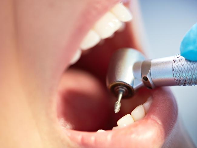 Health authorities say a healthy mouth, teeth and gums may reduce your risk of chronic disease. Picture: iStock