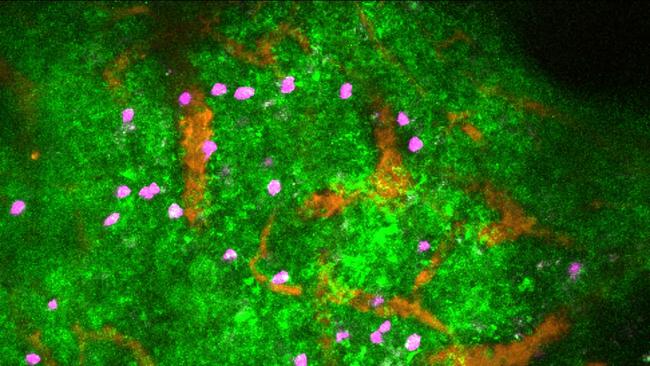 Lymphocytes (purple) can be seen among blood vessels (orange) and the calcium signalling (green) that results from noradrenaline neurotransmitter release and causes immune cells to stop moving. Picture: Scott Mueller