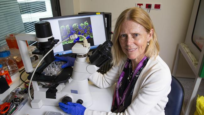 Professor Melissa Little studies a sample of tissue that has been 3D printed to become a Kidney. Picture: Aaron Francis