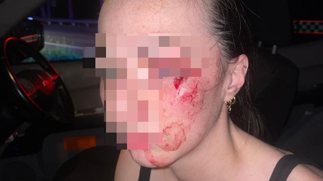 A woman was injured after a large rock struck her face on Wednesday evening. Picture: Supplied