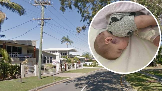 A six-month-old baby has had to undergo emergency surgery after being mauled by a large dog in an "unprovoked" attack.