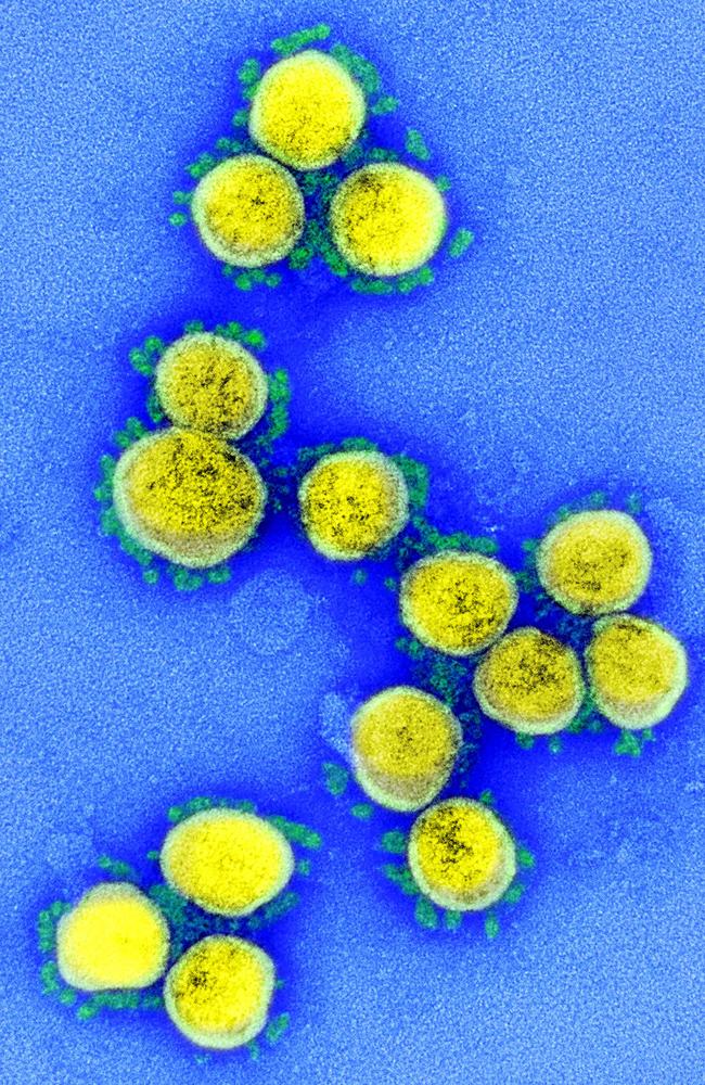 A transmission electron micrograph of SARS-CoV-2 virus particles, isolated from a patient, captured and colour-enhanced at the NIAID Integrated Research Facility (IRF) in Fort Detrick, Maryland.