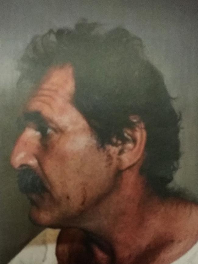 Heinze also sustained injuries during his attack upon two women at Salt Creek.