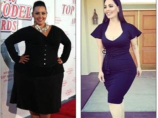 Model trolled after losing 114kg 