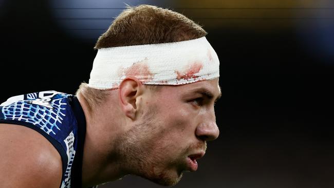 Harry McKay of the Blues looks on during the 2023 AFL Round 10 match between the Carlton Blues and the Collingwood Magpies at the Melbourne Cricket Ground on May 21, 2023 in Melbourne, Australia. (Photo by Michael Willson/AFL Photos via Getty Images)