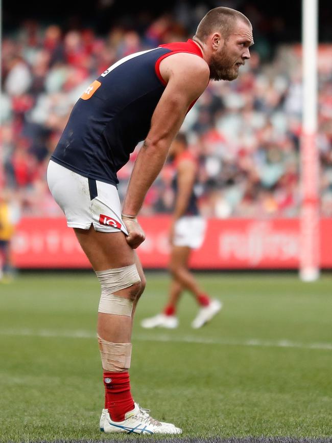 Max Gawn after the Round 23 loss to Collingwood.