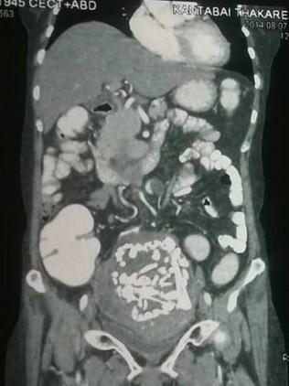 An MRI scan reveals the unborn baby’s bones.