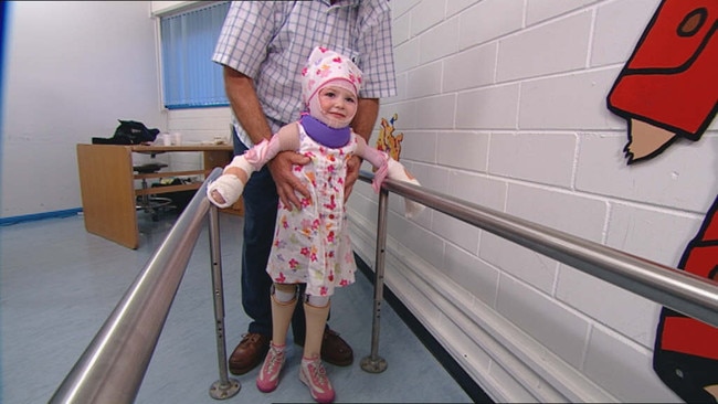 Sophie was just two years old when a car crashed into her childcare centre.<a href="https://www.dailytelegraph.com.au/newslocal/northern-beaches/sophie-delezios-dad-talks-about-how-his-familys-life-changed-forever-after-accident/news-story/bac0795ab1245dbf5e0a94a396514f8f"></a>