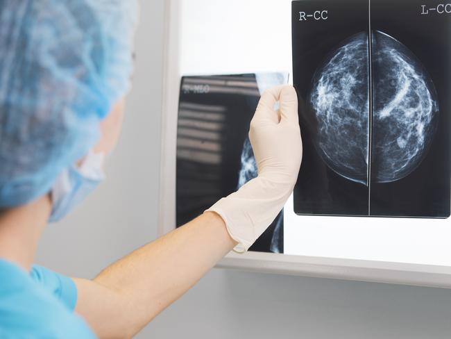 woman doctor or nurse in surgery outfit is holding a mammogram in front of x-ray illuminator