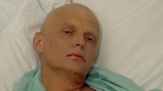 Litvinenko lies in his hospital bed. Picture: Getty Images