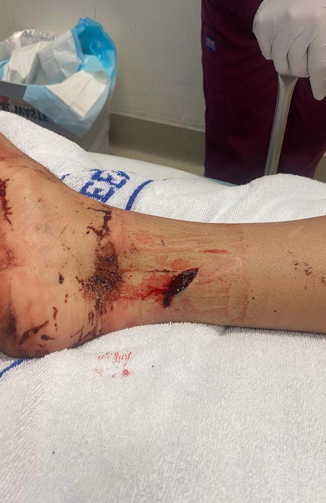 Noah Hooper was stabbed in the leg during an incident at Stockland car park.