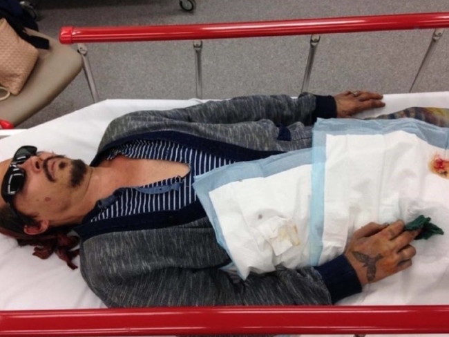 Johnny Depp, pictured in a hospital bed with a severed finger. Picture: Schillings