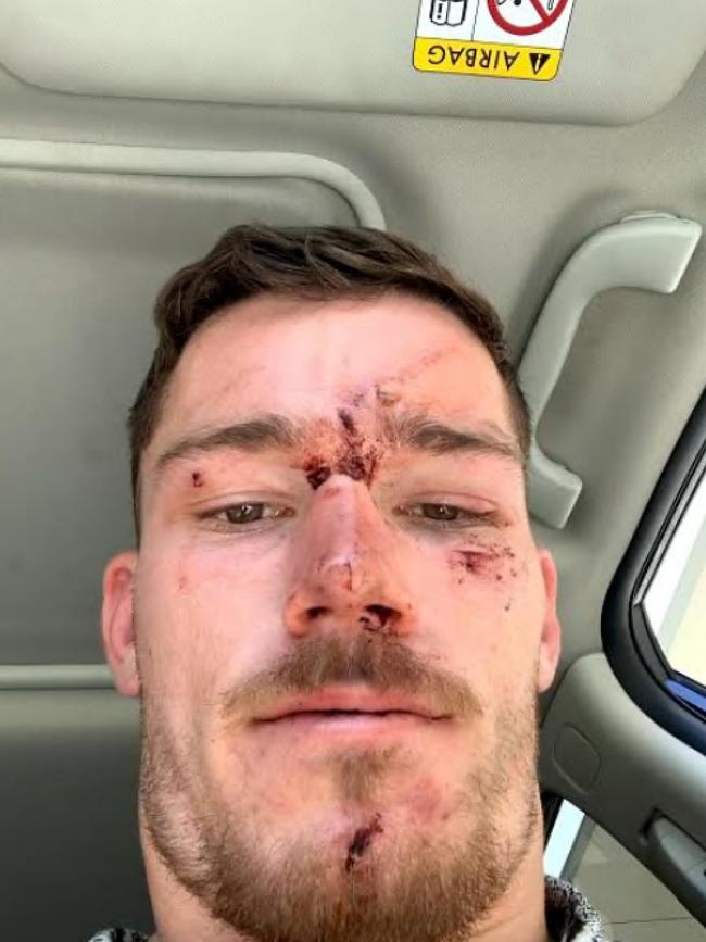 Canberra Raiders player Tom Starling posted this image to social media in December 2020. Picture supplied