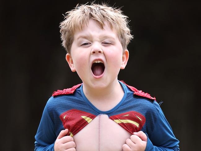 WARNING HOLD FOR Good Friday Appeal 2024 RCH. Xavier Grant 6, Kawasaki s disease. Left coronary heart bypass. Xavier shows his super hero zipper scar from his open heart surgery wearing his favourite super hero Superman at home in Warrnambool.                      Picture: David Caird