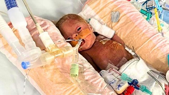 Little baby Stephanie lived the first part of her life hooked up to machines in hospital. Pictures: Contributed