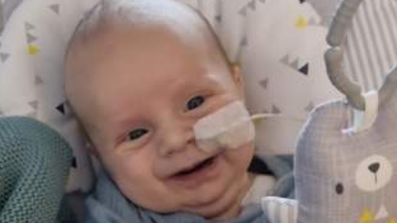 Sunshine Coast baby Charlie Dunn born with his intestines outside of his body. Picture - contributed.