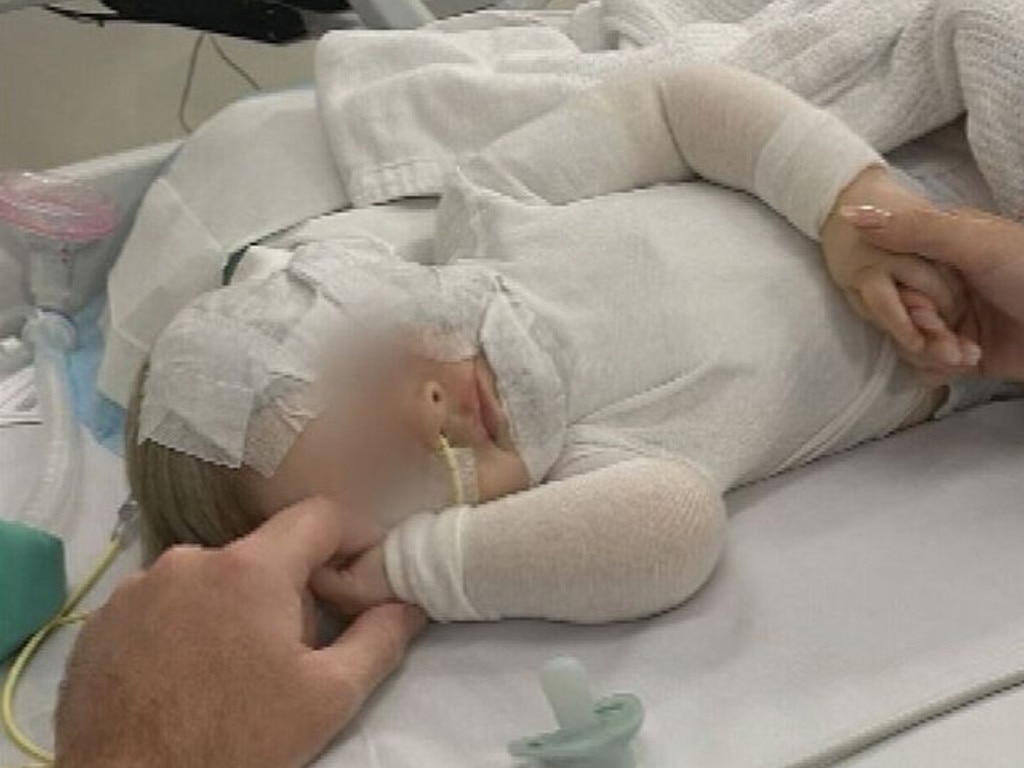 The baby has undergone seven surgeries after hot coffee was poured over him. Picture: Nine News