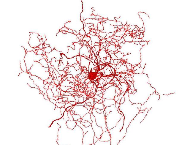 Digital reconstruction of a rosehip neuron in the human brain showing bundle of nerve fibres around central cell body. Picture: University of Szeged