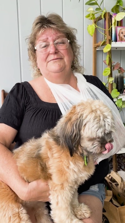 'Thought I'd lose my hand': Dog attack victim speaks