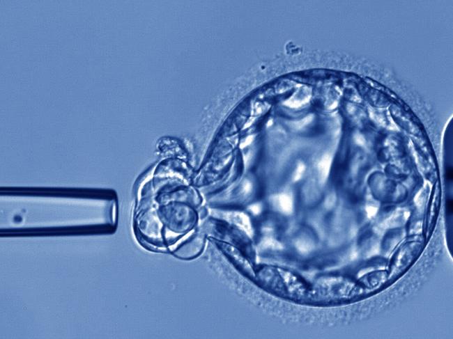 Scientists at Monash IVF Group  have developed a non-invasive embryo screening test that will reduce miscarriages and the time it takes to achieve a healthy live birth.