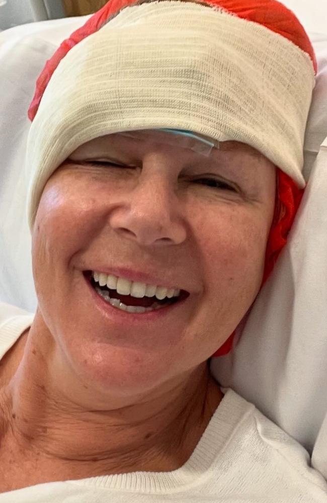 Julia Morris after having a skin cancer removed. Picture: Instagram