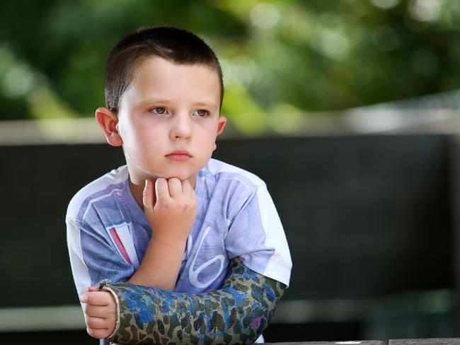 Christopher French, 5, of Cedarvale, fell off a retaining wall. Picture: Peter Cronin