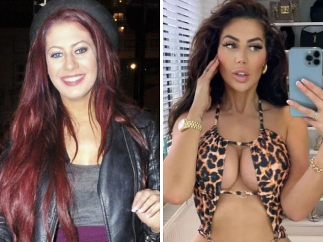 Reality star Chloe Ferry slams troll over surgery comment
