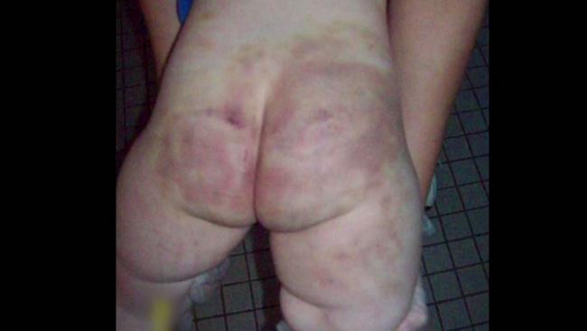 Mason’s mother’s was alerted to her son’s severe bruising in the months and weeks before his death. Picture: Channel 9