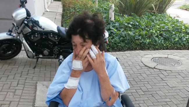 Terrorised: Nicci Simpson in recovery after she was assaulted on her farm in South Africa in 2017.