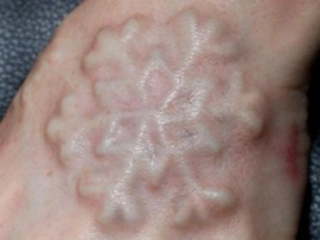 A silicone snowflake like the one inserted into a woman’s hand by Russell.