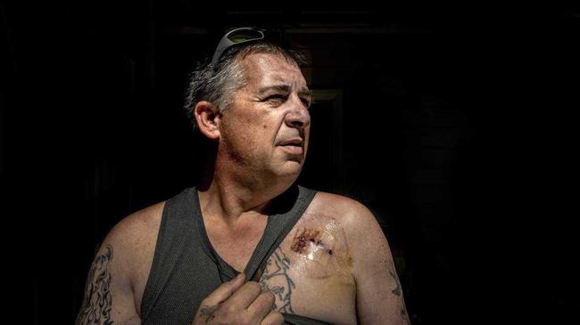 Gerry Reside shows off his scar after he was revived from a heart attack at the rear of the Grafton PO Hotel. He is looking for 'Dave', who gave him CPR and saved his life. Picture: Adam Hourigan