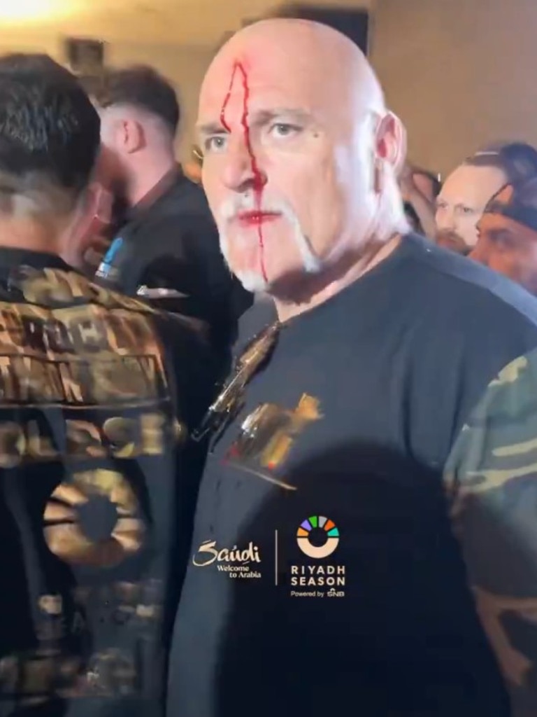 John Fury was spilling blood.