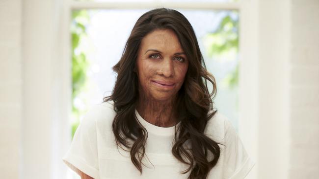 Turia Pitt calls Mollymook home.