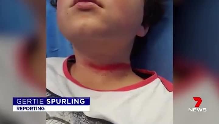 SEVEN NEWS: 9 year old suffers rope burns to his neck