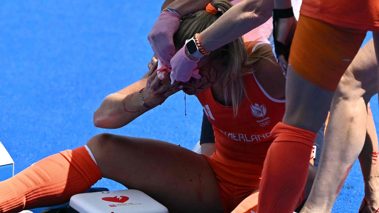 Netherlands' forward Joosje Burg left a lot of blood on the field. Photo by Arun SANKAR / AFP.