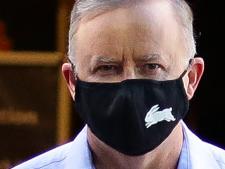 SYDNEY, AUSTRALIA - JANUARY 09, 2021: Anthony Albanese Leader of the Opposition and Leader of the Labor Party is seen leaving the RPA Hospital today after a car accident yesterday in Marrickville in Sydney, Australia. Picture: Newscorp - Sunday Telegraph / Gaye Gerard