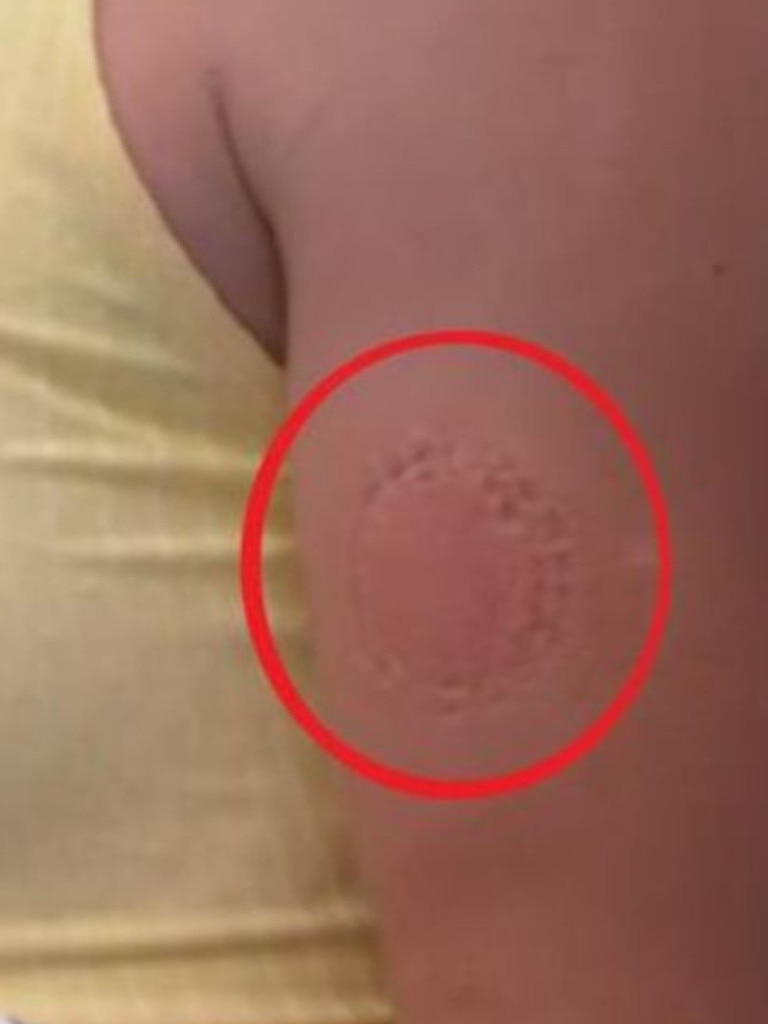 The match was so intense, the frustrated teen was seen leaving a bite mark on her own upper arm. Picture: Fox Sports