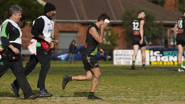 SFNL: A Doveton player leaves the field bloodied. Picture: Valeriu Campan