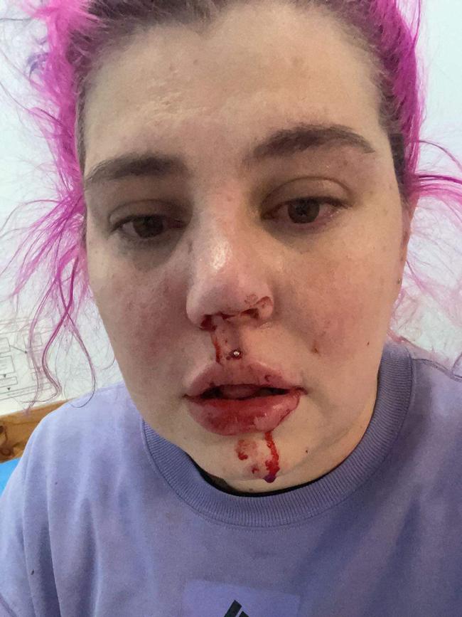 Lara Gilchrist was allegedly attacked by a homeless man in Cranbourne. Picture: Supplied