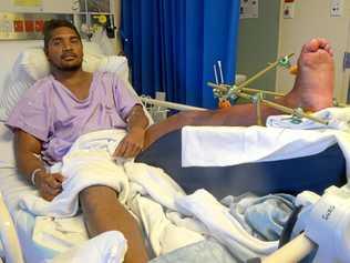 Norths centre Troyson Bassani suffered a broken tibia and fibula during Sunday's game. Picture: Jann Houley