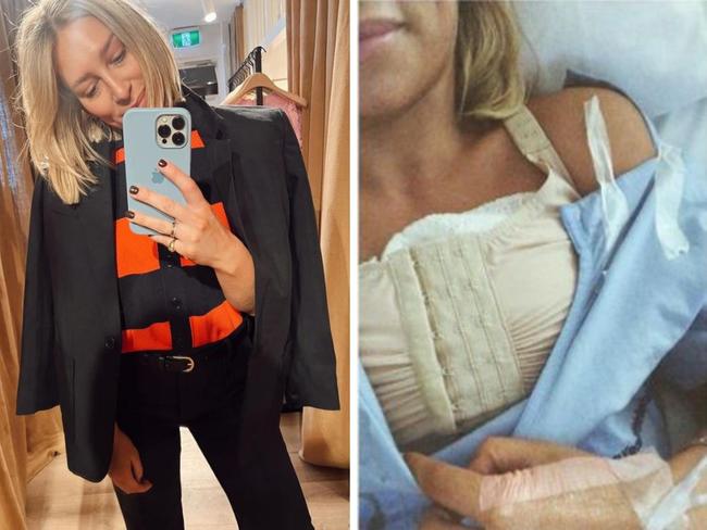 Phoebe Burgess has opened up about her decision to undergo a breast reduction, after a “volatile” lifelong relationship with her boobs. Picture: Instagram