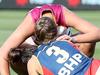 An AFLW knee injury and the road out of hell