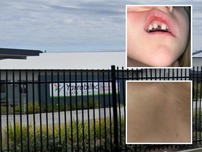 Parents petition to end violence at Yarrabilba State School